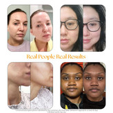 کپسول تقویت کننده پوست اسکین تامین هرتامین